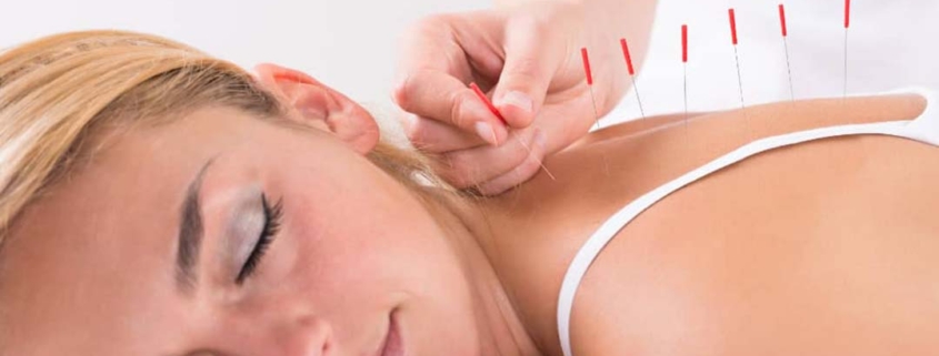 Acupuncture in NW Calgary