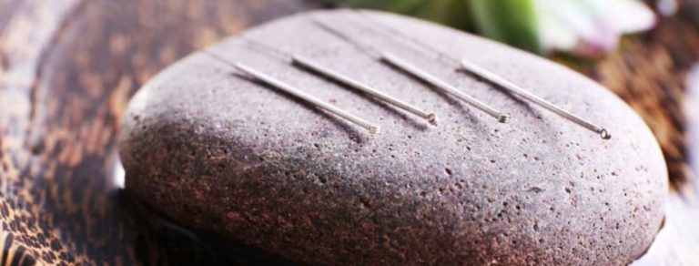acupuncture-pain-relief-nw-calgary